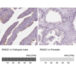RIIAD1 Antibody, Novus Biologicals 25 &mu;L, Unlabeled:Antibodies, Polyclonal